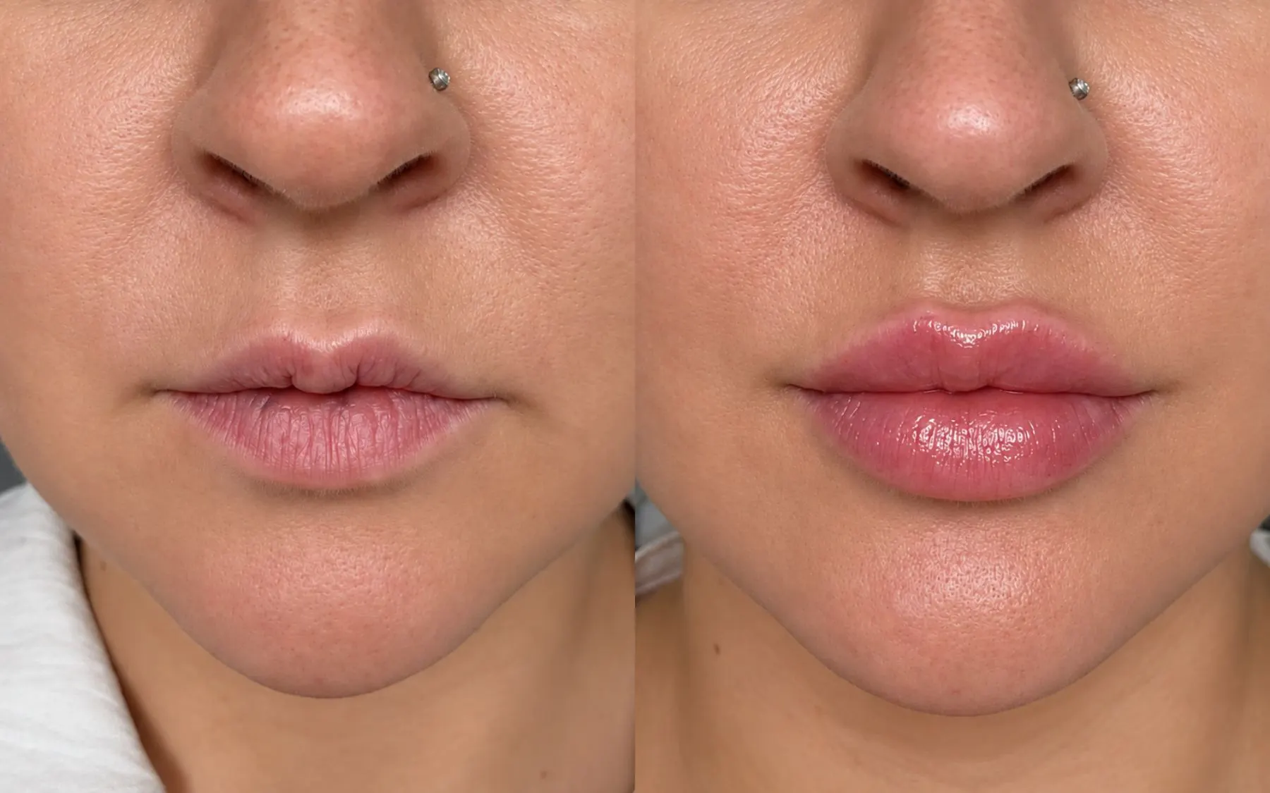 Lip enhancement result