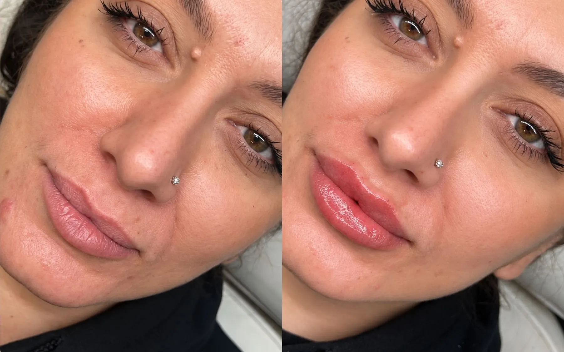 Lip enhancement result