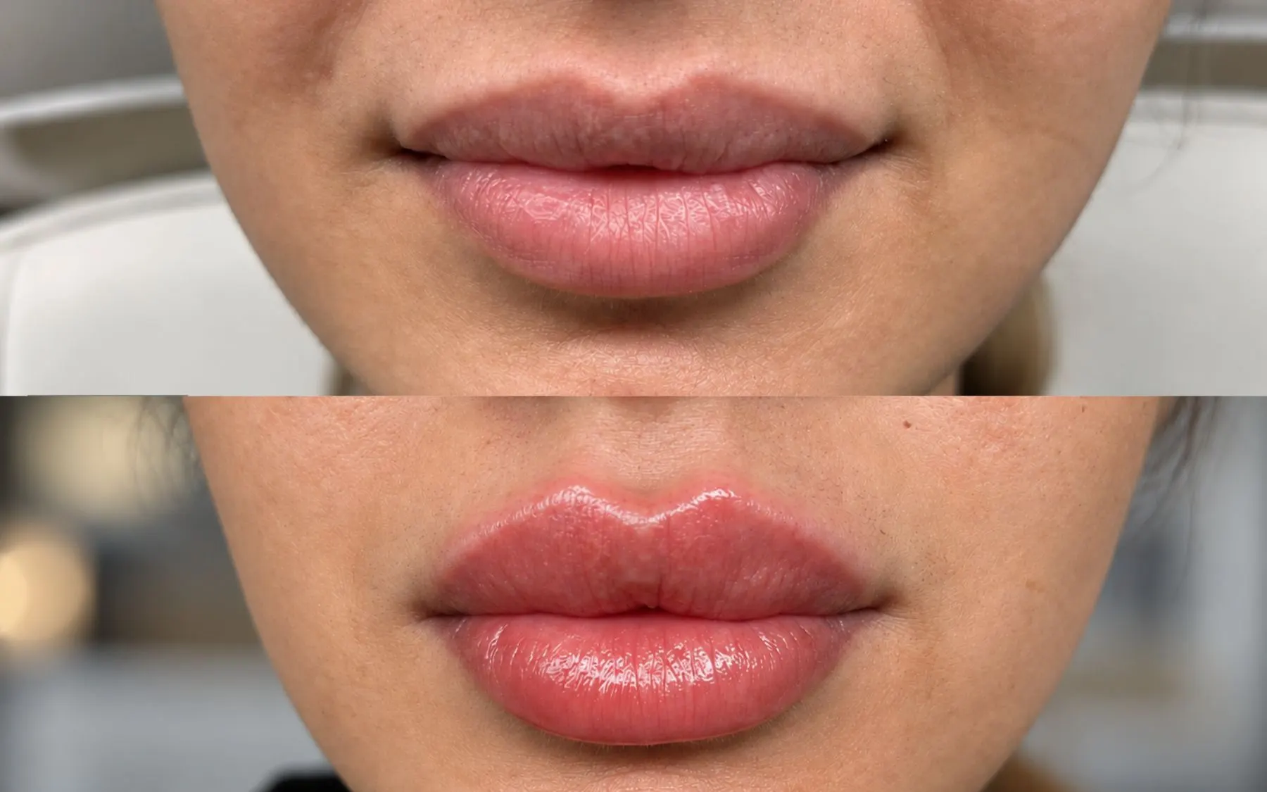 Lip enhancement result