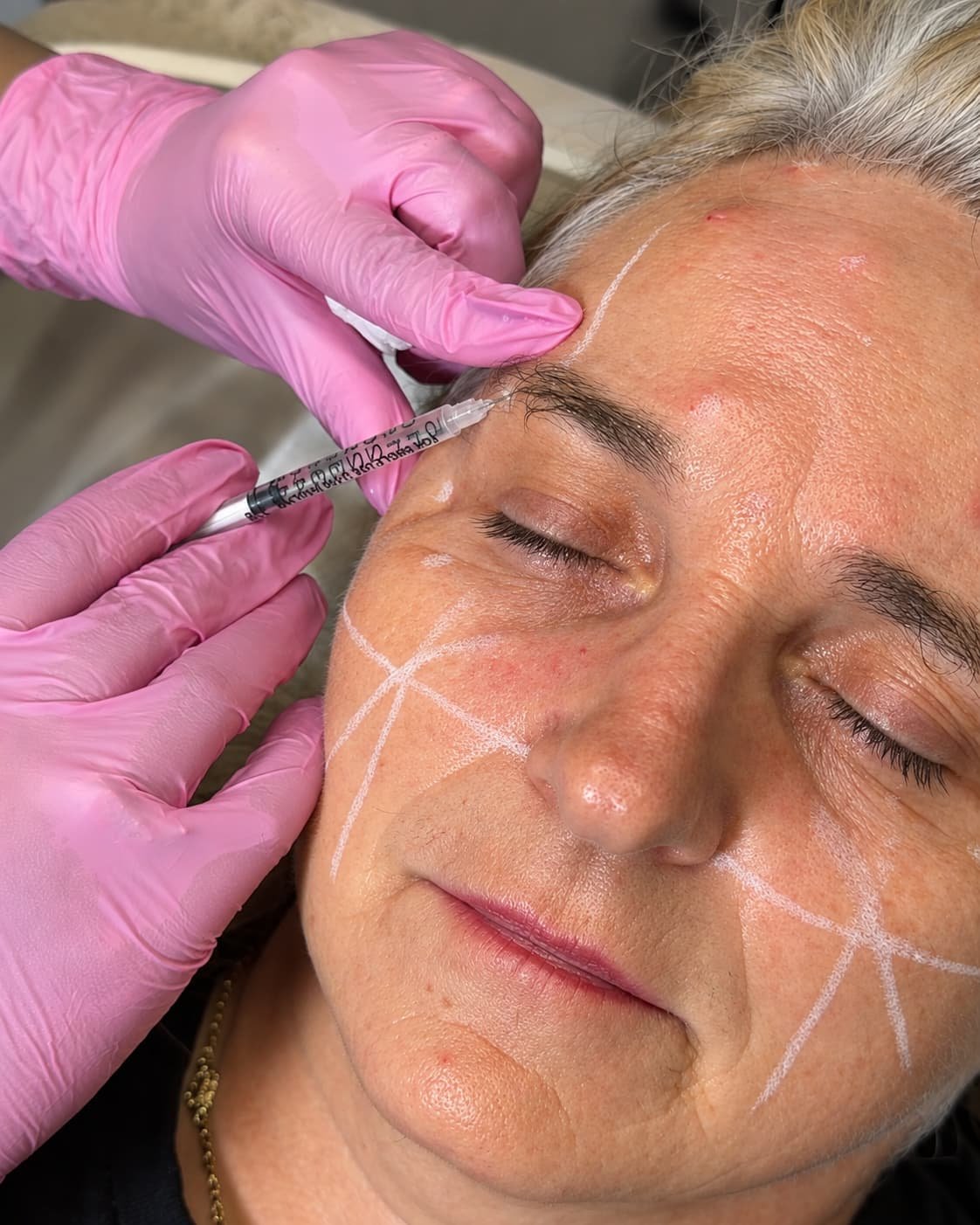 Lenka providing a personalised aesthetic treatment