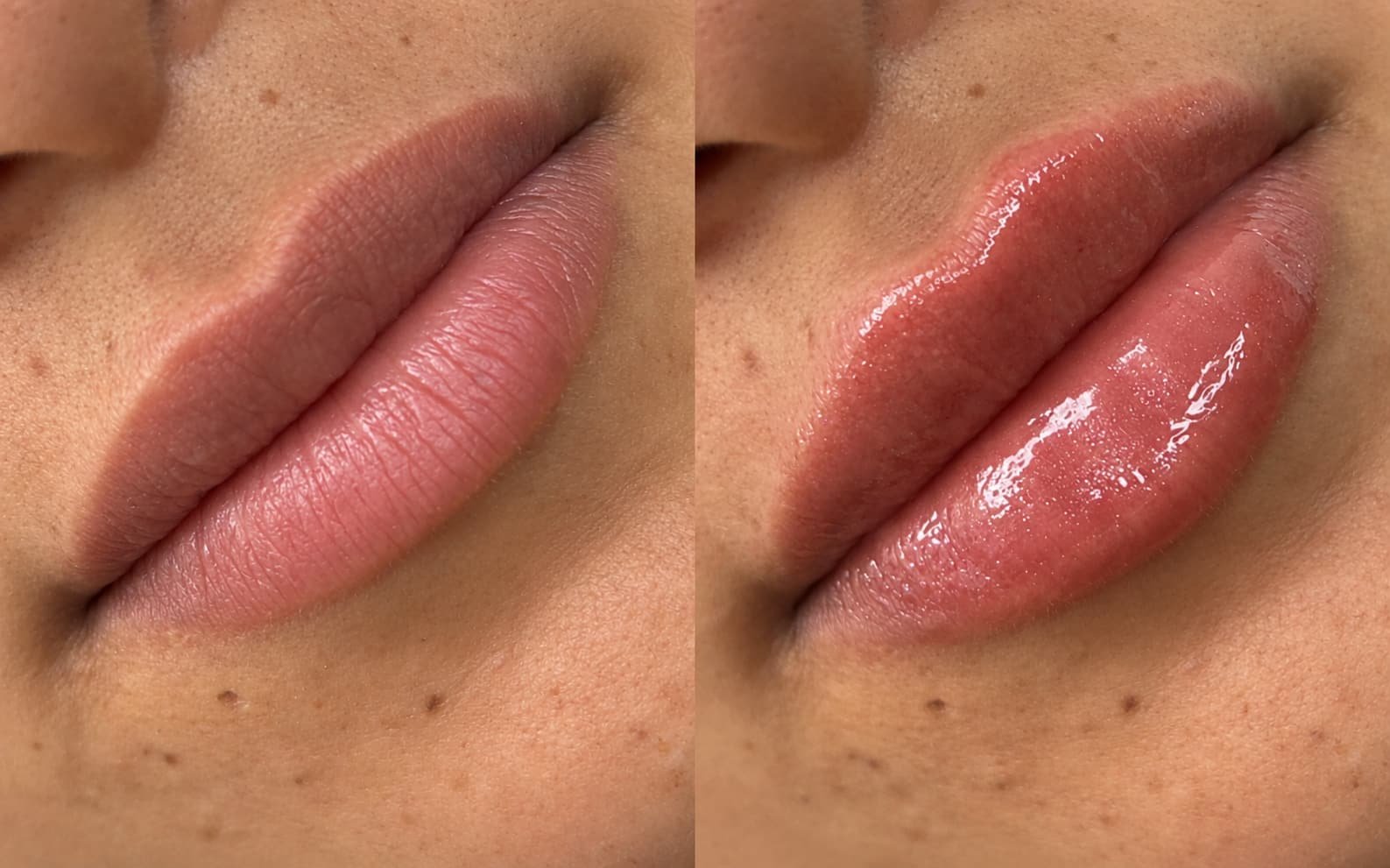 Lip enhancement result