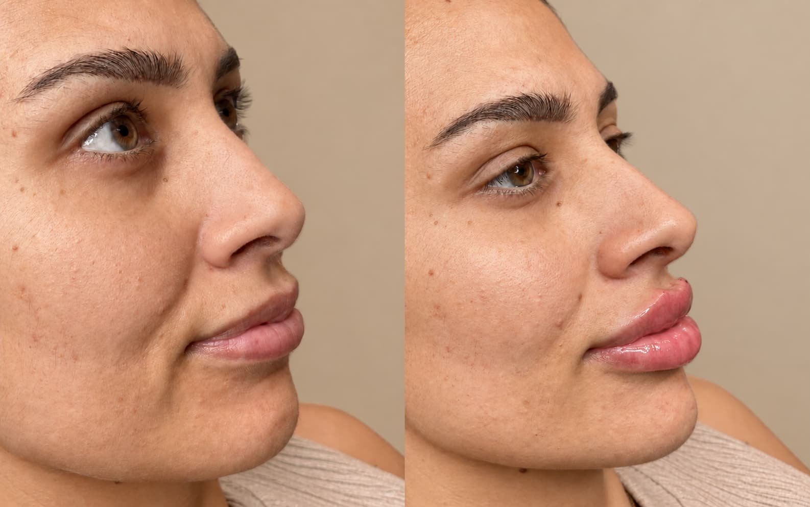Lip enhancement result